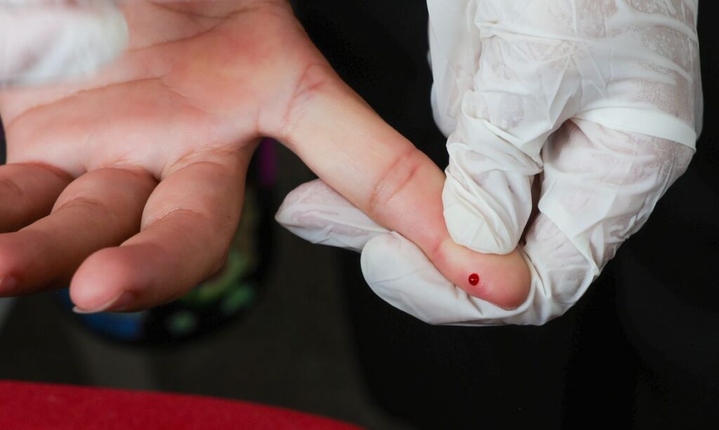 Teste rápido de dengue passa a integrar tabela do SUS