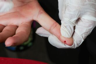 Teste rápido de dengue passa a integrar tabela do SUS