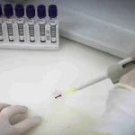 Exames descartam ebola em imigrante da República Democrática do Congo