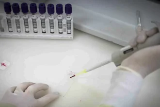 Exames descartam ebola em imigrante da República Democrática do Congo